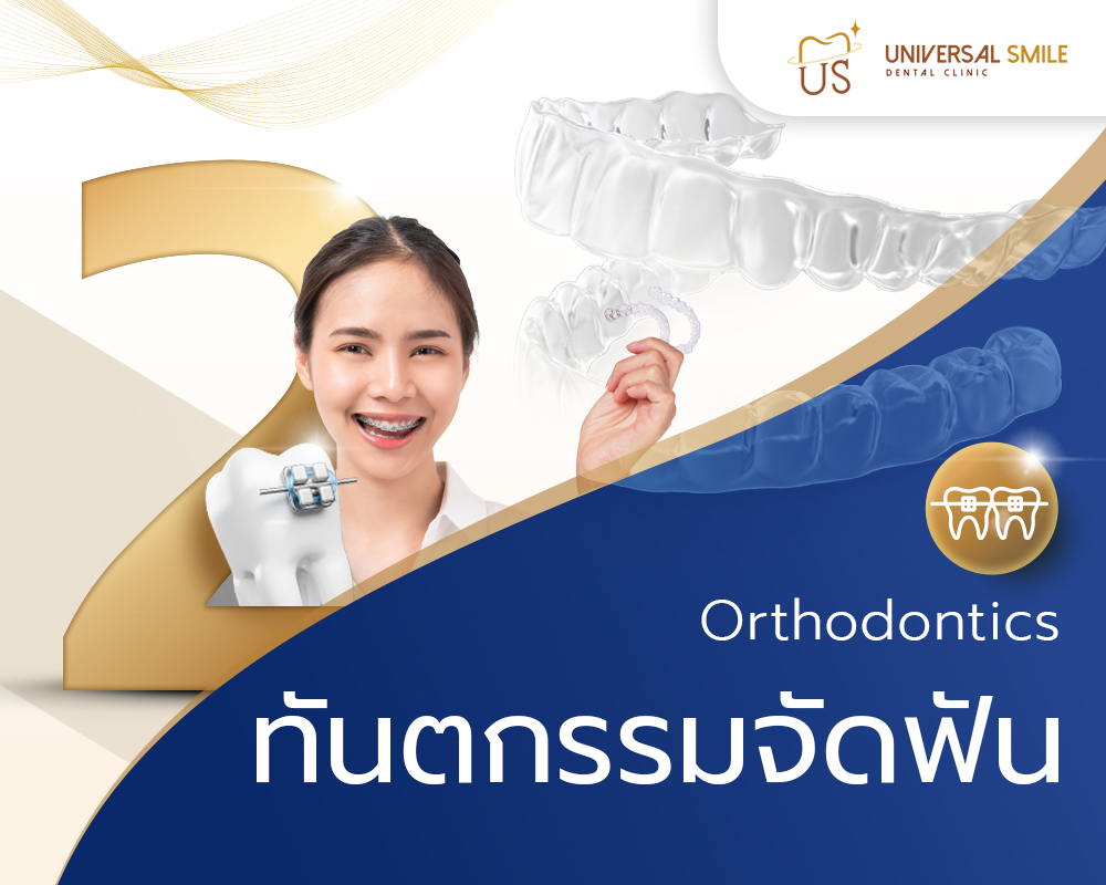 ทันตกรรมจัดฟัน